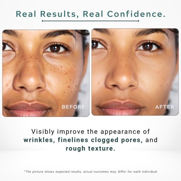 23% Vitamin C + Retinol Serum | Anti-Aging, Glow Boost, Fine Line Repair - 30ml / 1 fl.oz - Image 5